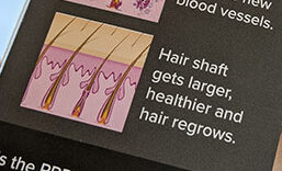 how PRP works to regrow hair